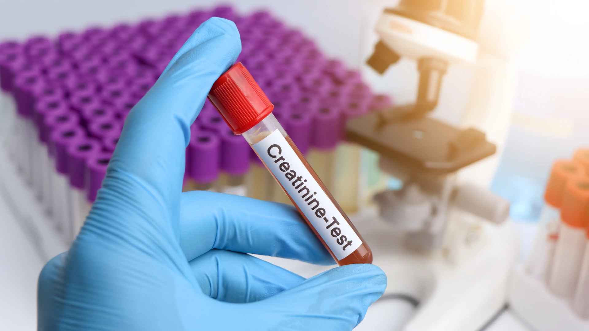 Creatinine